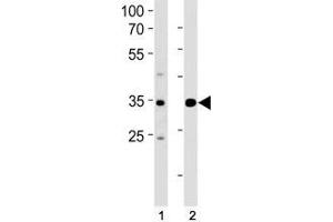 Western Blotting (WB) image for anti-Activating Transcription Factor 4 (Tax-Responsive Enhancer Element B67) (ATF4) (AA 171-198) antibody (ABIN3029849)