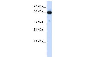 SLC39A4 antibody used at 1 ug/ml to detect target protein.