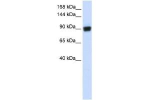 RAD54B antibody used at 1 ug/ml to detect target protein. (RAD54B 抗体)