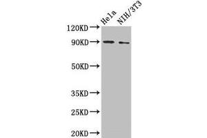Western Blot Positive WB detected in: Hela whole cell lysate, NIH/3T3 whole cell lysate All lanes: L1CAM antibody at 2 μg/mL Secondary Goat polyclonal to rabbit IgG at 1/50000 dilution Predicted band size: 141, 140, 139 kDa Observed band size: 90 kDa (L1CAM 抗体  (AA 995-1119))