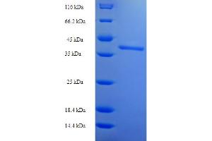 SDS-PAGE (SDS) image for butyrophilin, Subfamily 2, Member A2 (BTN2A2) (AA 33-262), (Isoform 2), (partial) protein (His-SUMO Tag) (ABIN5711664)