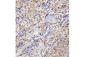 Immunohistochemistry of paraffin embedded rat spleen using GP1BA (ABIN7074109) at dilution of 1:500 (300x lens) (CD42b 抗体)
