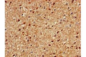 Immunohistochemistry of paraffin-embedded human brain tissue using ABIN7166170 at dilution of 1:100 (Chromosome 1 Open Reading Frame 84 (C1orf84) (AA 2396-2517) 抗体)