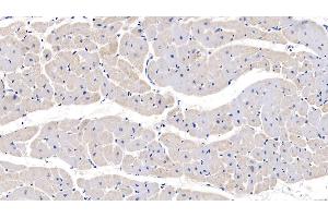 Immunohistochemistry (IHC) image for anti-Protein Tyrosine Phosphatase Type IVA, Member 3 (PTP4A3) (AA 1-170) antibody (ABIN7435550)
