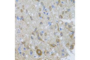 Immunohistochemistry of paraffin-embedded rat brain using DYNC1I1 antibody at dilution of 1:100 (x40 lens). (DYNC1I1 抗体)