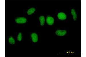 Immunofluorescence of purified MaxPab antibody to NFATC2IP on HeLa cell. (NFATC2IP 抗体  (AA 1-138))