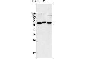 Western blot analysis using NF-κB p65 mouse mAb against Jurkat (1), K562 (2) and NIH/3T3 (3) cell lysate. (NF-kB p65 抗体)