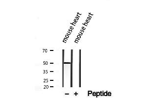 Western blot analysis of extracts from mouse heart, using CRLS1-Specific antibody. (CRLS1 抗体  (Internal Region))