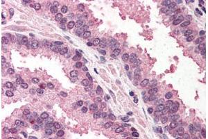Human Prostate (formalin-fixed, paraffin-embedded) stained with RAD23A antibody ABIN290446 at 5 ug/ml followed by biotinylated anti-goat IgG secondary antibody ABIN481715, alkaline phosphatase-streptavidin and chromogen. (RAD23A 抗体  (AA 122-135))