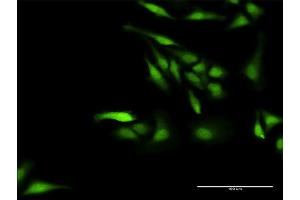 Immunofluorescence of purified MaxPab antibody to NPLOC4 on HeLa cell. (NPLOC4 抗体  (AA 1-608))