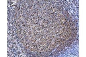 IHC analysis of TOMM40 using anti-TOMM40 antibody (ABIN7599738).