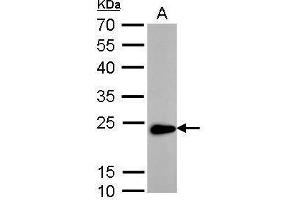 Western Blotting (WB) image for anti-Transgelin (TAGLN) antibody (ABIN2855103)