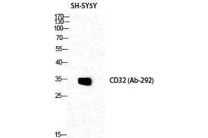 Western Blotting (WB) image for anti-Fc gamma RII (CD32) (Ser376) antibody (ABIN3183763) (Fc gamma RII (CD32) (Ser376) 抗体)