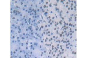 IHC-P analysis of Human Tissue, with DAB staining. (CPSF1 抗体  (AA 1-300))