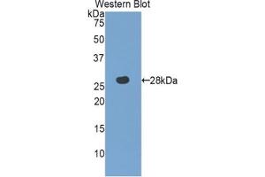 Western blot analysis of the recombinant protein. (MPST 抗体  (AA 68-278))