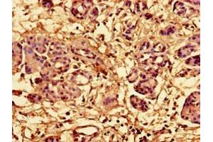 Immunohistochemistry of paraffin-embedded human pancreatic tissue using ABIN7142792 at dilution of 1:100 (RPL28 抗体  (AA 2-137))
