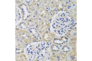 Immunohistochemistry of paraffin-embedded rat kidney using TUBB8 antibody. (Tubulin, beta 8 抗体)
