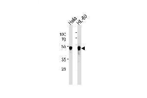 Lane 1: HeLa Cell lysates, Lane 2: HL-60Cell lysates, probed with VRK1 (1015CT2. (VRK1 抗体)