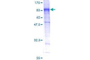 ITFG3 Protein (AA 1-552) (GST tag)