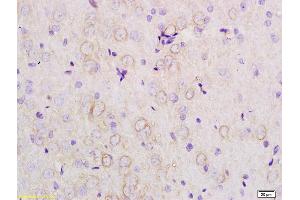 Formalin-fixed and paraffin embedded rat brain tissue labeled with Anti-APOE3 Polyclonal Antibody, Unconjugated (ABIN708761) at 1:200 followed by conjugation to the secondary antibody (APOE 抗体  (AA 101-180))