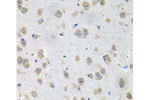 Immunohistochemistry of paraffin-embedded Mouse brain using GNE Polyclonal Antibody at dilution of 1:100 (40x lens). (GNE 抗体)