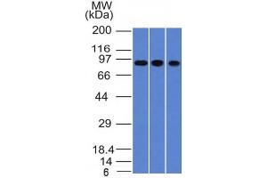 Western Blot of A549, HepG2 & HCT116 cell lysates with Villin Monoclonal Antibody (VIL1/1314). (Villin 1 抗体  (AA 179-311))