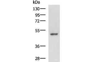 Western blot analysis of Hela cell lysate using MYCN Polyclonal Antibody at dilution of 1:800 (MYCN 抗体)
