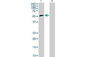 Western Blot analysis of TFG expression in transfected 293T cell line by TFG MaxPab polyclonal antibody. (TFG 抗体  (AA 1-400))