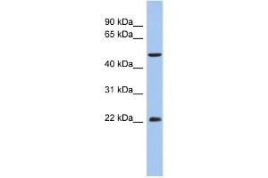 WB Suggested Anti-ANKH Antibody Titration:  0. (ANKH 抗体  (N-Term))