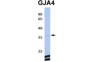 Host:  Rabbit  Target Name:  GJA4  Sample Type:  MCF7  Antibody Dilution:  1. (GJA4 抗体  (Middle Region))
