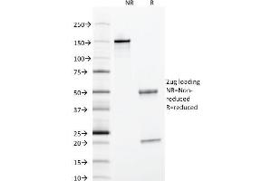 SDS-PAGE Analysis Purified Alpha-1-Antitrypsin Mouse Monoclonal Antibody (AAT/1378). (SERPINA1 抗体)