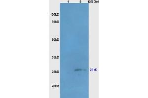 Lane 1: mouse liver lysates Lane 2: mouse brain lysates probed with Anti Bcl-10/CLAP/CIPER Polyclonal Antibody, Unconjugated (ABIN749828) at 1:200 in 4 °C. (BCL10 抗体  (AA 81-180))