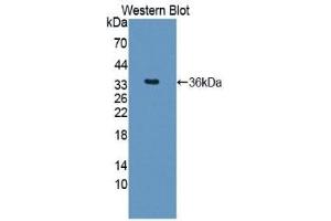 WB of Protein Standard: different control antibodies against Highly purified E.