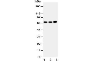 Western blot testing of GBP1 antibody and Lane 1:  U87;  2: HeLa;  3: MCF-7 cell lysate (GBP1 抗体  (AA 566-589))