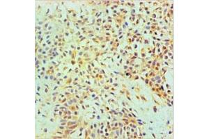 Immunohistochemical of paraffin-embedded Human Breast tissue using ABIN7144345 at dilution of 1:200. (Annexin A2 抗体)