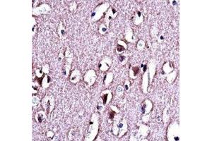 LMO2 antibody immunohistochemistry analysis in formalin fixed and paraffin embedded human brain tissue. (LMO2 抗体  (AA 1-30))