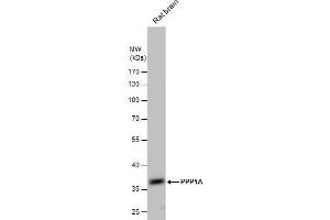 Western Blotting (WB) image for anti-Protein Phosphatase 1, Catalytic Subunit, alpha Isoform (PPP1CA) (Center) antibody (ABIN2856071)