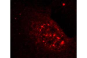 Immunofluorescence staining of methanol-fixed Hela cells showing nuclear dot staining using Phospho-AKT1-T308 antibody. (AKT1 抗体  (pThr308))