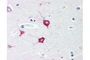 Anti-TOLLIP antibody IHC of human brain, cortex. (TOLLIP 抗体  (C-Term))