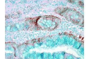 Immunohistochemistry analysis using Rabbit Anti-HSP70 Polyclonal Antibody . (HSP70 抗体  (PerCP))