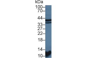 Western blot analysis of Rat Kidney lysate, using Rat STAP1 Antibody (1 µg/ml) and HRP-conjugated Goat Anti-Rabbit antibody ( (STAP1 抗体  (AA 1-297))