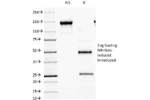 SDS-PAGE Analysis Purified MALT1 Mouse Monoclonal Antibody (MT1/410). (MALT1 抗体  (AA 701-808))