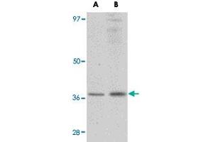 Western blot analysis of RSPO1 in rat spleen tissue lysate with RSPO1 polyclonal antibody  at (A) 1 and (B) 2 ug/mL . (RSPO1 抗体  (N-Term))