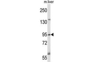 Western Blotting (WB) image for anti-Gen Endonuclease Homolog 1 (GEN1) antibody (ABIN3004202) (GEN1 抗体)
