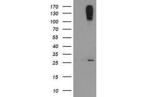 Image no. 7 for anti-C-Type Lectin Domain Family 4, Member E (CLEC4E) antibody (ABIN1497530)