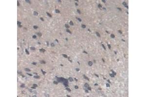 Used in DAB staining on fromalin fixed paraffin- embedded Kidney tissue (Recoverin 抗体  (AA 2-200))