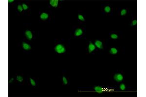 Immunofluorescence (IF) image for anti-V-Akt Murine Thymoma Viral Oncogene Homolog 1 (AKT1) (AA 1-480) antibody (ABIN559829)