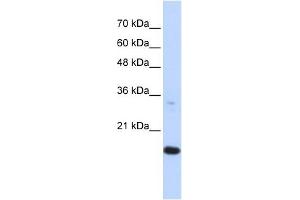 GABARAPL1 antibody used at 1 ug/ml to detect target protein. (GABARAPL1 抗体)