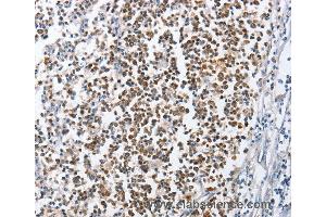 Immunohistochemistry of Human tonsil using MCM6 Polyclonal Antibody at dilution of 1:45