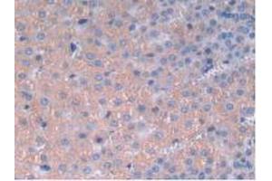 IHC-P analysis of Rat Adrenal Gland Tissue, with DAB staining. (IL12A 抗体  (AA 23-215))